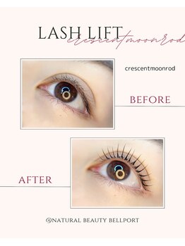 ナチュラル ビューティー ベルポート(natural beauty Bellport)/ラッシュリフトビフォーアフター