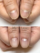 マリーロール 天王寺店(Marie Laure)/深爪改善/自爪育成/ネイルケア