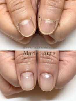 マリーロール 天王寺店(Marie Laure)/深爪改善/自爪育成/ネイルケア