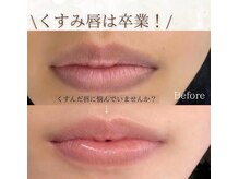 ベイビースキン(Baby skin)/ローマピンクLip