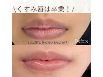 ベイビースキン(Baby skin)/ローマピンクLip