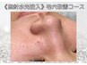 【無針水光注入】毛穴洗浄・毛穴引き締めコース