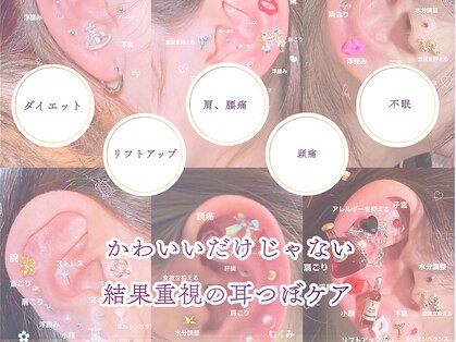 レビーリズ(Revie Liz)の写真