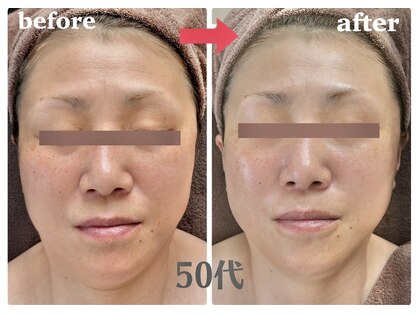 エステティック サロン ノナ(NONA)の写真