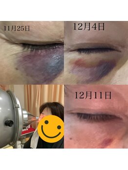 トータルヘルスビューティーカズ(TotalHealthBeauty KAZU)/【肌トラブルも改善】光の森