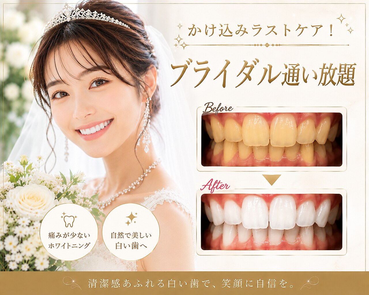 【医療提携】ホワイトニングメニュー導入　単品可 クーポン・メニュー｜ヌールホワイト 御徒町店(NOOR WHITE