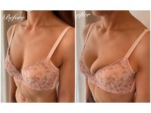 美バストアルファ(美bust α)/【バストアップ】50代のお客様