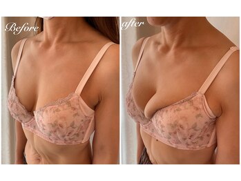 美バストアルファ(美bust α)/【バストアップ】50代のお客様