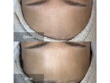 ルミナス(Luminous)/ララピール