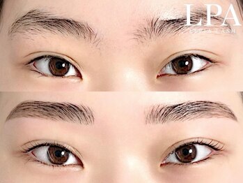 レピア 仙台店/韓国式LEPIA Before&Aｆter