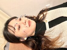 美容鍼