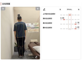 かがりの整骨院 東近江八日市院/AIによる姿勢分析(後面)