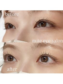 ミテ(mite)/まつげパーマのビフォーアフター