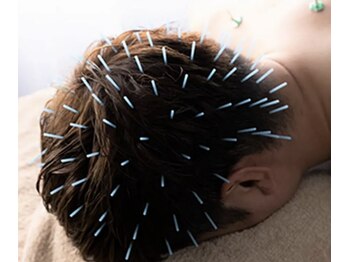 グラン治療院 東京/頭の鍼