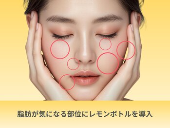 癒し工房ゆらぎ(YURAGI)/2.レモンボトルの特徴