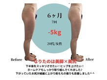 ベル(BeL)/筋膜リリース×痩身【6ヶ月】