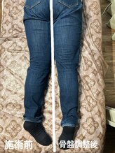 グランツ(GLANZ)/反り腰