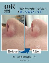 サロンエス(SALON:S)/潤い・ツヤが復活