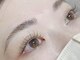 ルネル(Lunelle)の写真