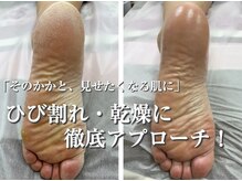 コトリ(Kotori)の雰囲気（見せたくない足裏も丁寧な角質ケアで見せたくなる素足へ）