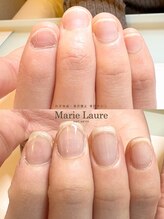 マリーロール 梅田店(Marie Laure)/自爪育成/深爪矯正/ネイルケア