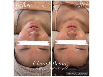 クリーンアンドビューティ 札幌(Clean&Beauty)/韓国エステ3200店舗も導入実績!
