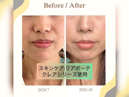 サロン ド メタセコイア(salon de Metasequoia)の写真