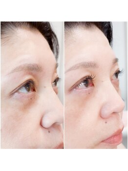 ルミナス アイ 町田店(Luminous Eye)/マツエク100本