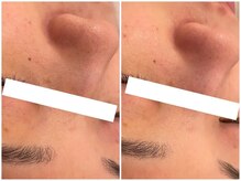 メゾンリュバン 天王寺(Maison Ruban)/ララピール・水玉リフティング