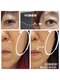さりぃず ねぃる(SALLY’S NAIL)の写真/フェイシャル+*初めての方へ+*ヒリヒリ無しで肌管理♪小顔効果☆THRひかり+*継続で目がぱっちり大きくなる
