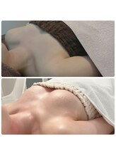 カナエルサロン 旭川(KANAERU SALON)/【バストアップ】症例☆