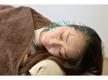 北梅田美容鍼灸院/【大阪/梅田】美容鍼灸
