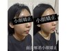 【お子様同伴可】医師推奨の悩みに応じた小顔矯正60分
