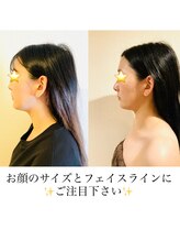 セルフィッシュ(Cellfish)/小顔＆全身矯正（ブライダル）