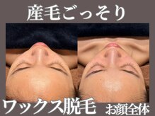 マヴィ 守口店(MavY.)/そのザラつきは産毛かも！