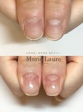 マリーロール 淀屋橋本店(Marie Laure)/自爪育成/深爪矯正/ネイルケア