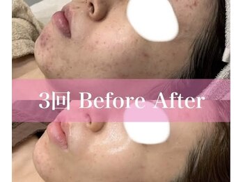 スリリアン 銀座/★お客さまビフォーアフター★