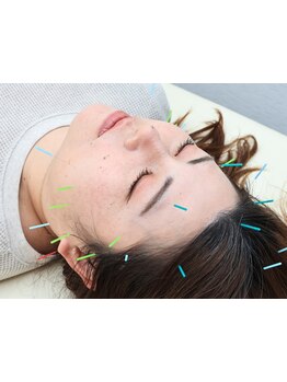 小顔になりたい