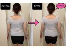 イーリス(i-ris)/美容整体×骨盤調整×リンパ