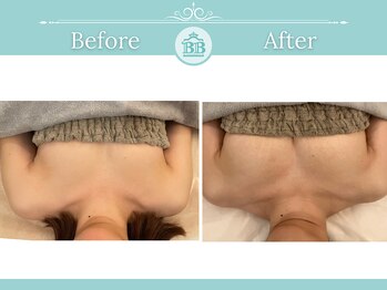 美人バスト 浜松店/◆バストアップ &nbsp;BeforeAfter◆