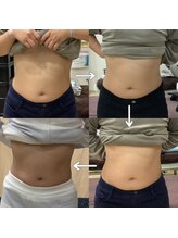 トータルヘルスビューティーカズ(TotalHealthBeauty KAZU)/【ダイエット・痩身】光の森