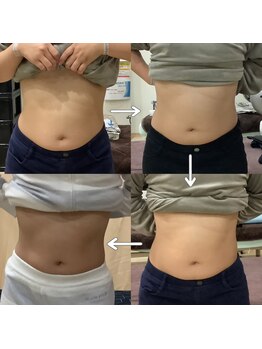トータルヘルスビューティーカズ(TotalHealthBeauty KAZU)/【ダイエット・痩身】光の森