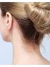 【女性のみ】うなじ　ワックス脱毛