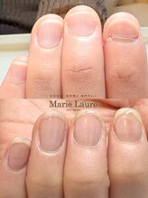 マリーロール 梅田店(Marie Laure)/自爪育成/深爪矯正/ネイルケア