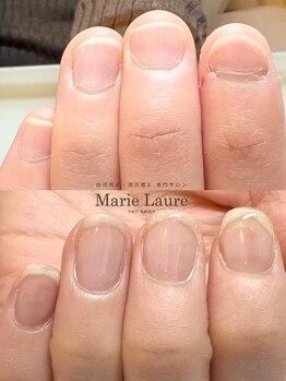 マリーロール 梅田店(Marie Laure)/自爪育成/深爪矯正/ネイルケア