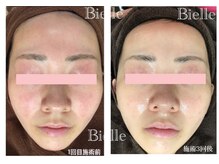 ビエル(Bielle)/コントロールカラー卒業！