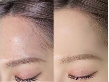 アンフルール プリエ 恵比寿店(Une fleur prier)/フェイシャルワックス(おでこ)