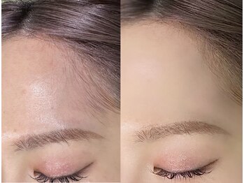 アンフルール プリエ 恵比寿店(Une fleur prier)/フェイシャルワックス(おでこ)