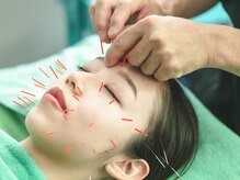 ボディーキュア アオイ(Body cure Aoi)の雰囲気（体の不調も美容鍼も同時施術可【美容鍼 /鍼灸/整体/マッサージ】）