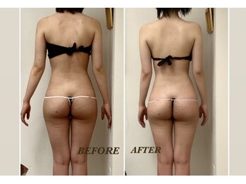 プリマ 栄店(Prima)/BEFORE&AFTER